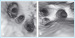 Aktuelles Bild - Abb. 3a-b: Pulmonalvenen-Anatomie
