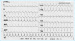 Abb. 1: EKG