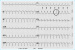 Abb. 2: 12-Kanal-EKG
