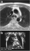Abb. 7a-b: Turbospinechosequenz - Gradientenechosequenz
