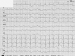 Aktuelles Bild - Abb. 1: EKG
