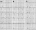 Abb. 2: EKG