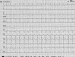 Abb. 3: EKG