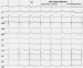 Aktuelles Bild - Abb. 1: EKG