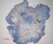 Aktuelles Bild - Abb. 2: Reflux