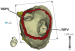 Abb. 3: CARTO-Merge