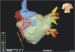Abb. 3: CT - Virtuelle Anatomie