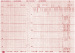 Abb. 1: EKG