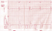 Aktuelles Bild - Abb. 2: EKG
