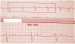 Aktuelles Bild - Abb. 2: EKG
