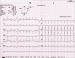 Aktuelles Bild - Abb. 1: EKG