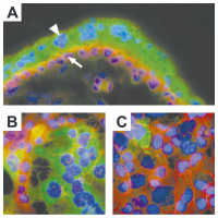 Abbildung 2a-c: Human placenta