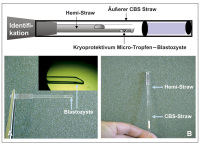 Abbildung 2: Hemi-Straw - CBS-Straw