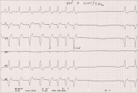 Abbildung 2: EKG