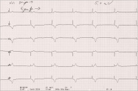 Abbildung 3: EKG