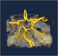 Abbildung 8: Circulus arteriosus