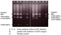 Abbildung 3: AZF deletion