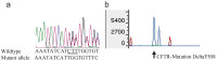 Abbildung 4a-b: PCR
