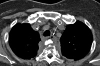 Abbildung 1b: Mediastinum