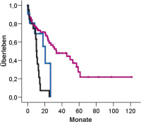 Abbildung 2: Intrahepatales Cholangiokarzinom