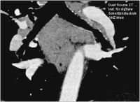 Abbildung 3: CT-Angiographie