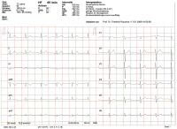 Abbildung 1: EKG