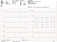 Abbildung 2: EKG