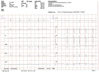 Abbildung 3: EKG