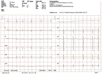Abbildung 4: EKG