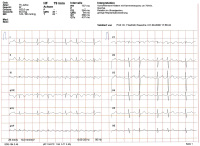Abbildung 5: EKG