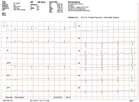 Abbildung 6: EKG