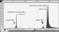 Abbildung 1: Fetale DNA - mtterliche DNA