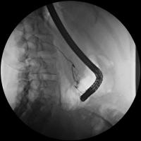 Abbildung 2: Ductus pancreaticus