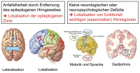 Abbildung 3: Epilepsie