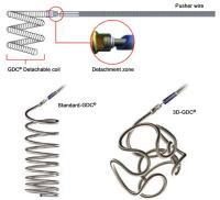 Abbildung 2: Intrakranielles Aneurysma - Coils