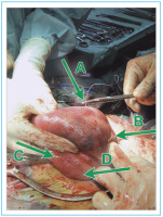 Abbildung 1: Damage Control Surgery