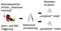 Abbildung 1: TEE - 3D-Echokardiographie