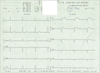 Abbildung 2: EKG