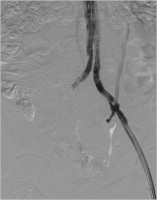 Abbildung 3: Angiogramm