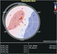 Abbildung 4: Speckle tracking