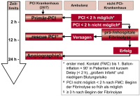 Abbildung 3: STEMI