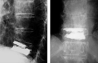 Abbildung 4: Postoperative Kontrolle