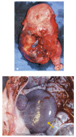 Abbildung 4a-b: Uterus