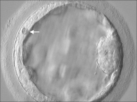 Abbildung 4: Blastocyst