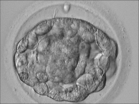 Abbildung 8: Blastocyst
