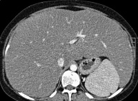Abbildung 1a: MDCT