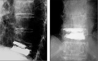 Abbildung 4: Thoracic vertebra