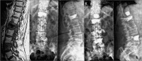 Abbildung 1: MRI STIR