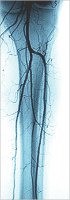 Abbildung 9: Angiographisches Ergebnis