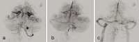Abbildung 2a-c: Arteria vertebralis